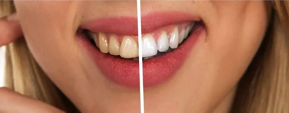 La cigarette électronique jaunit-elle les dents ?