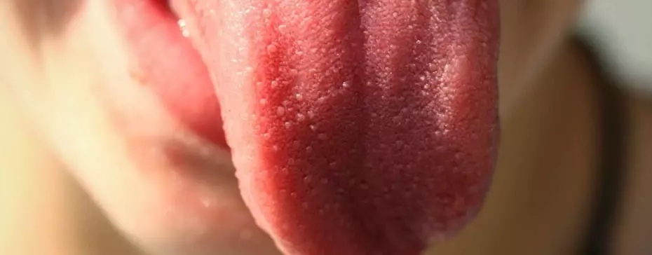 Mycose, sécheresse, perte de goût… Qu’est-ce que la langue de vape ?